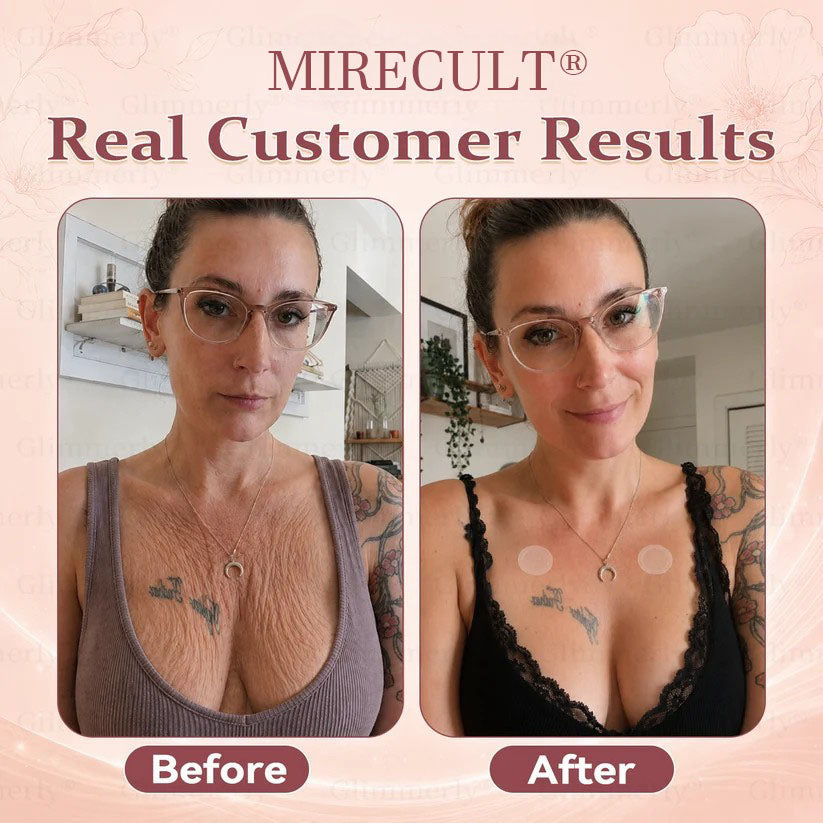 MIRECULT® Targeted Breast Enhancement Advanced Patch💖
