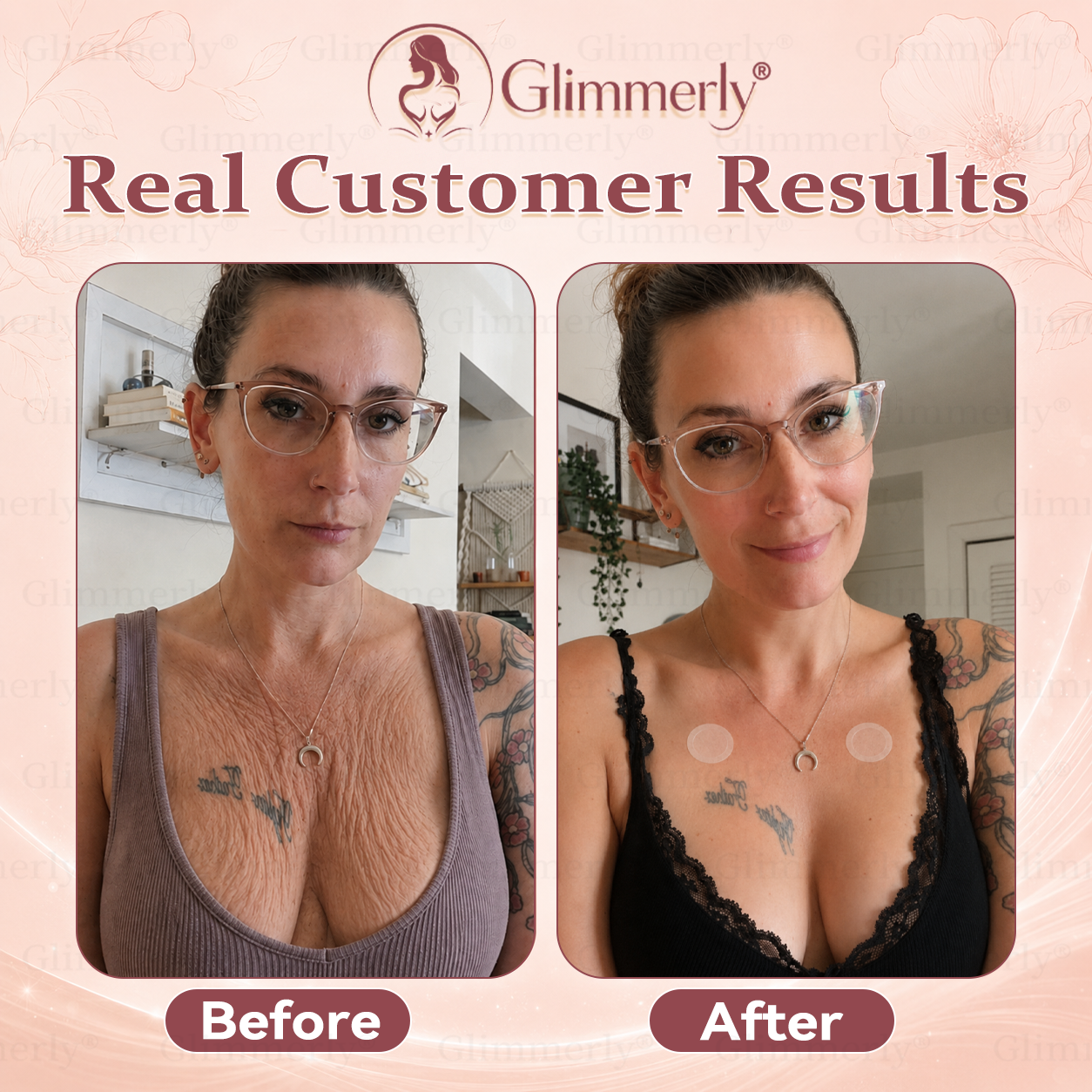 𝐆𝐥𝐢𝐦𝐦𝐞𝐫𝐥𝐲®✅ 𝐁𝐫𝐞𝐚𝐬𝐭 𝐕𝐨𝐥𝐮𝐦𝐞 𝐁𝐨𝐨𝐬𝐭 & 𝐅𝐢𝐫𝐦 𝐌𝐢𝐜𝐫𝐨-𝐍𝐞𝐞𝐝𝐥𝐞 𝐏𝐚𝐭𝐜𝐡𝐞𝐬💖