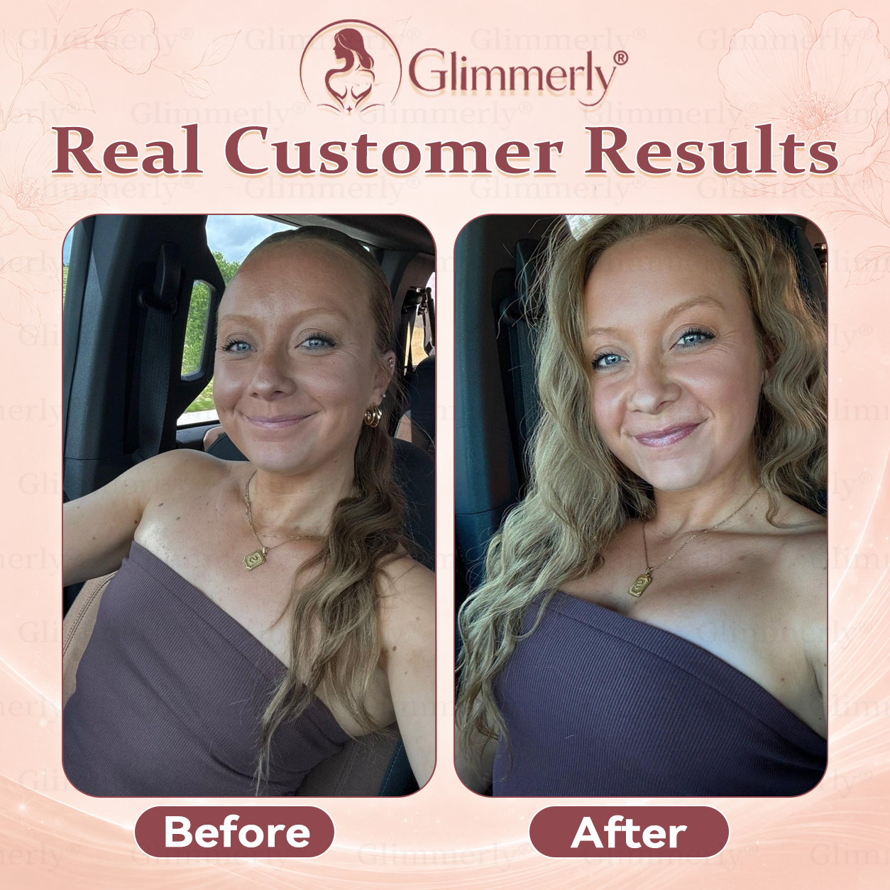 𝐆𝐥𝐢𝐦𝐦𝐞𝐫𝐥𝐲®✅ 𝐁𝐫𝐞𝐚𝐬𝐭 𝐕𝐨𝐥𝐮𝐦𝐞 𝐁𝐨𝐨𝐬𝐭 & 𝐅𝐢𝐫𝐦 𝐌𝐢𝐜𝐫𝐨-𝐍𝐞𝐞𝐝𝐥𝐞 𝐏𝐚𝐭𝐜𝐡𝐞𝐬💖