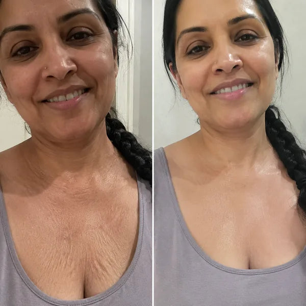 Divinvéra® – Visibly Firmer Skin in 14 Days