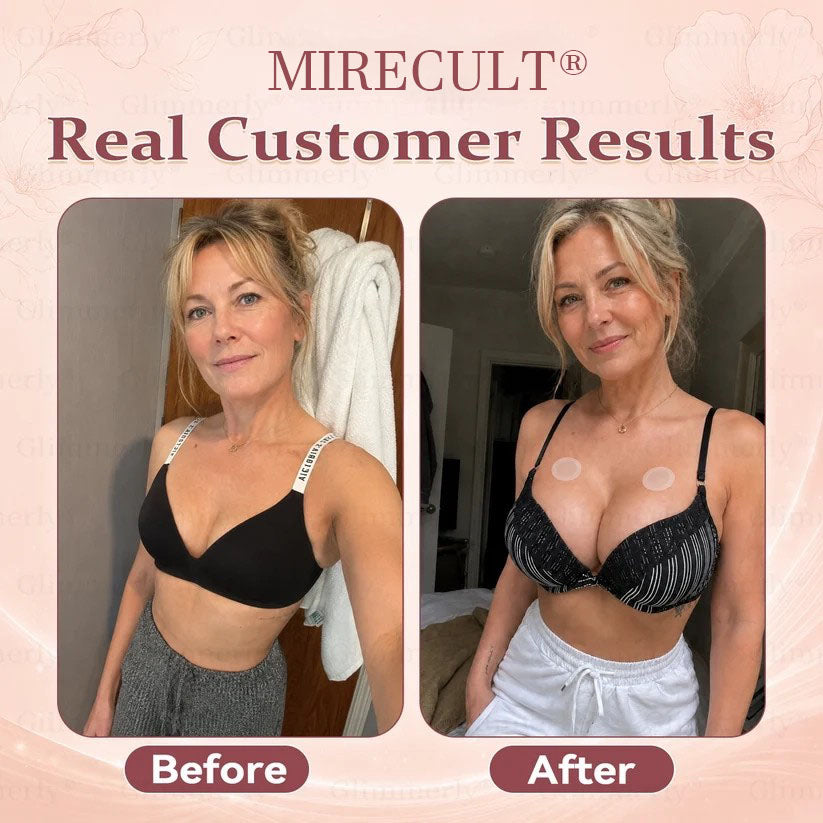 MIRECULT® Targeted Breast Enhancement Advanced Patch💖