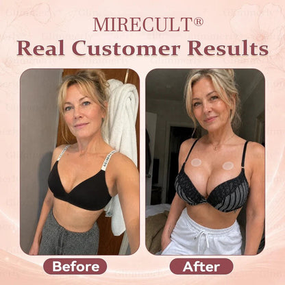 MIRECULT® Targeted Breast Enhancement Advanced Patch💖