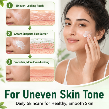 Herbal Vitiligo Cream&Bring Your Natural Skin Tone Back in 7 Days.