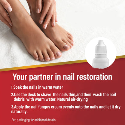 🦶 Fungi Nail Solution | Gentle Formula | Nail Repair & Beauty