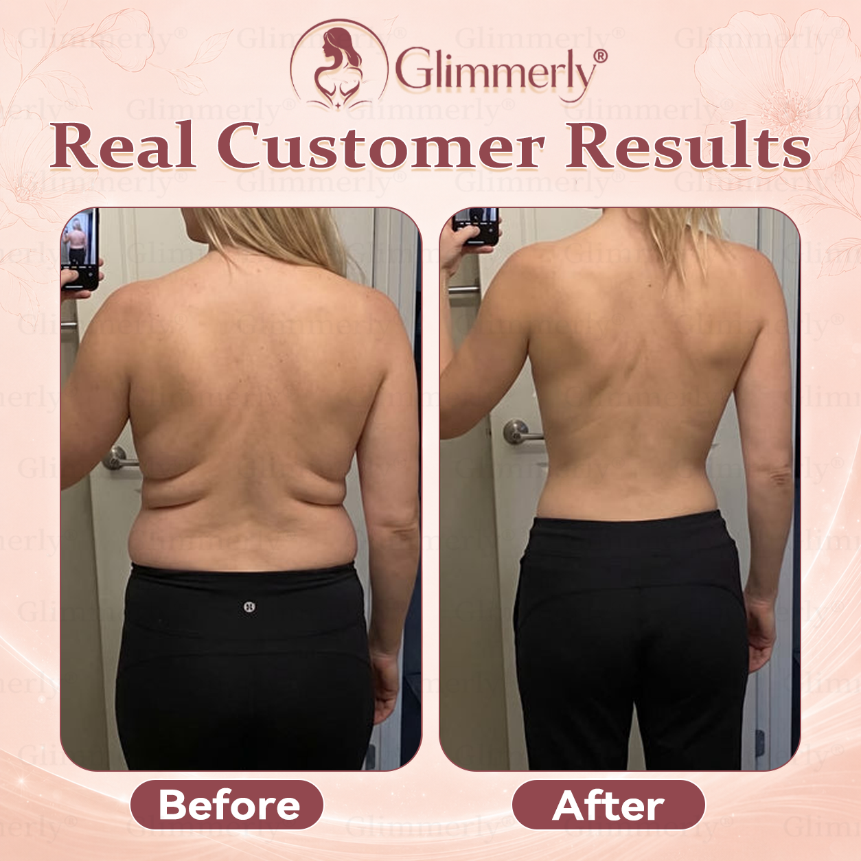 𝐆𝐥𝐢𝐦𝐦𝐞𝐫𝐥𝐲®✅ 𝐁𝐫𝐞𝐚𝐬𝐭 𝐕𝐨𝐥𝐮𝐦𝐞 𝐁𝐨𝐨𝐬𝐭 & 𝐅𝐢𝐫𝐦 𝐌𝐢𝐜𝐫𝐨-𝐍𝐞𝐞𝐝𝐥𝐞 𝐏𝐚𝐭𝐜𝐡𝐞𝐬💖