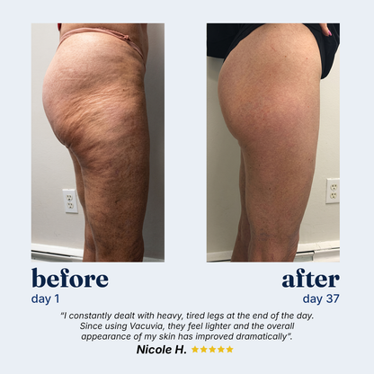 Vacuvia SculptGlow™ Firmer, More Toned Skin