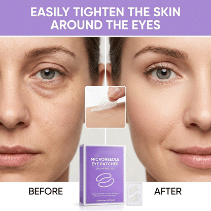 👁️👁️ WAKE UP LOOKING YEARS YOUNGER Hyaluronic Acid Microneedle Eye Mask