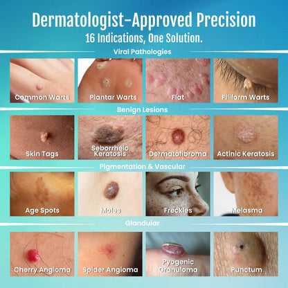 🔥80% OFF-💧SpotlessPro Advanced Skin Care Pen