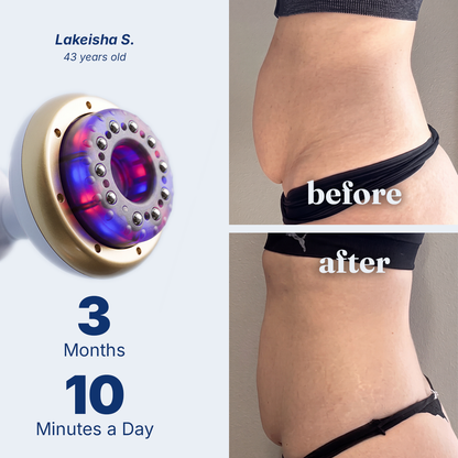 Vacuvia SculptGlow™ Firmer, More Toned Skin