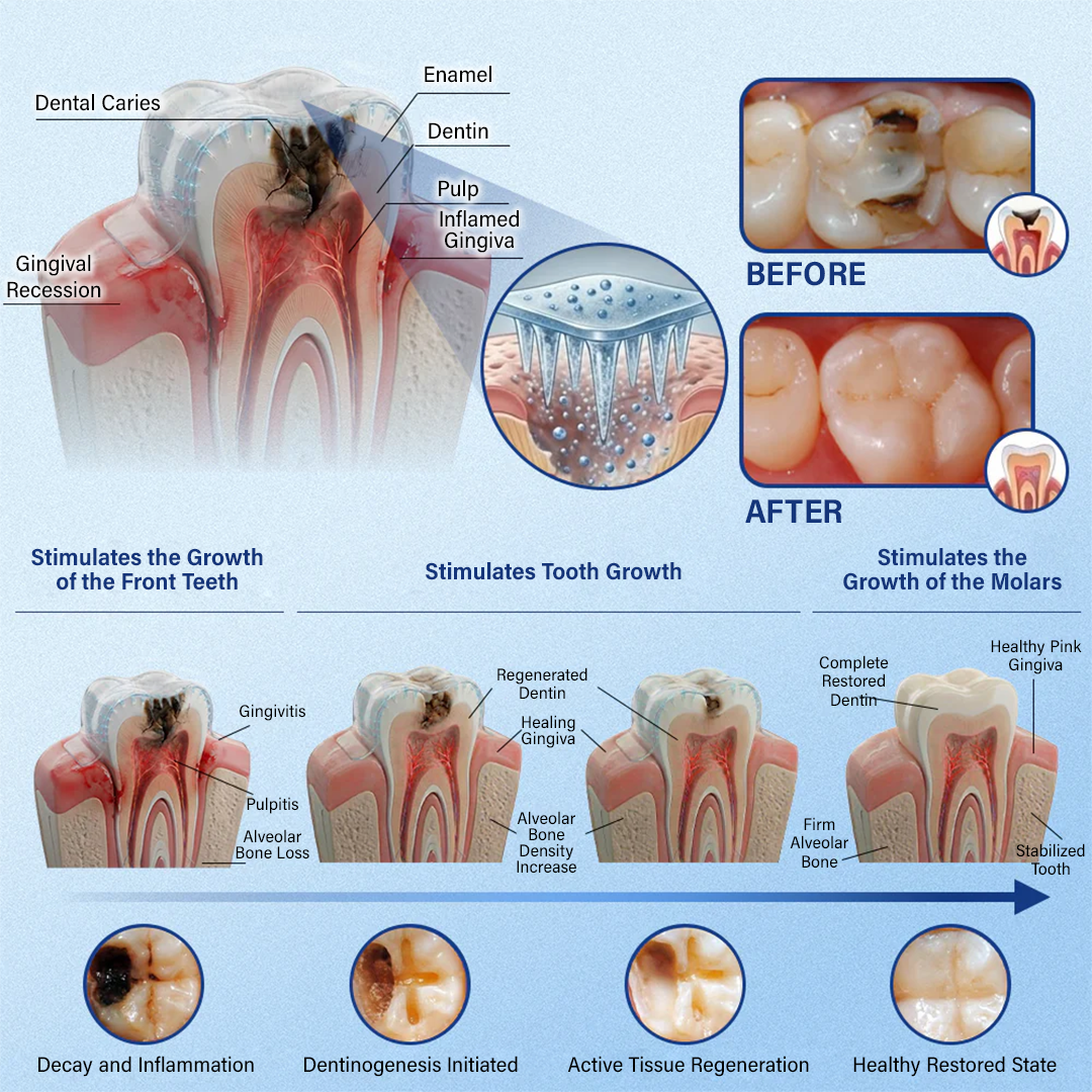 Tooth & Gum Care Fast-Dissolving Microneedle Patch
