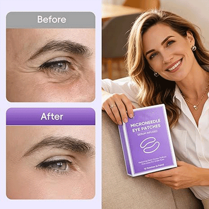 👁️👁️ WAKE UP LOOKING YEARS YOUNGER Hyaluronic Acid Microneedle Eye Mask