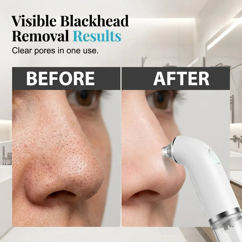 🔥😍Electric facial cleanser · Lifting and firming · Deep pore cleansing