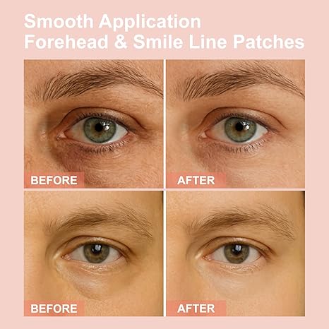👁️👁️ WAKE UP LOOKING YEARS YOUNGER Hyaluronic Acid Microneedle Eye Mask