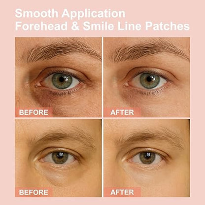 👁️👁️ WAKE UP LOOKING YEARS YOUNGER Hyaluronic Acid Microneedle Eye Mask