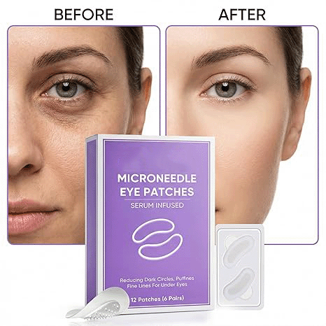 👁️👁️ WAKE UP LOOKING YEARS YOUNGER Hyaluronic Acid Microneedle Eye Mask