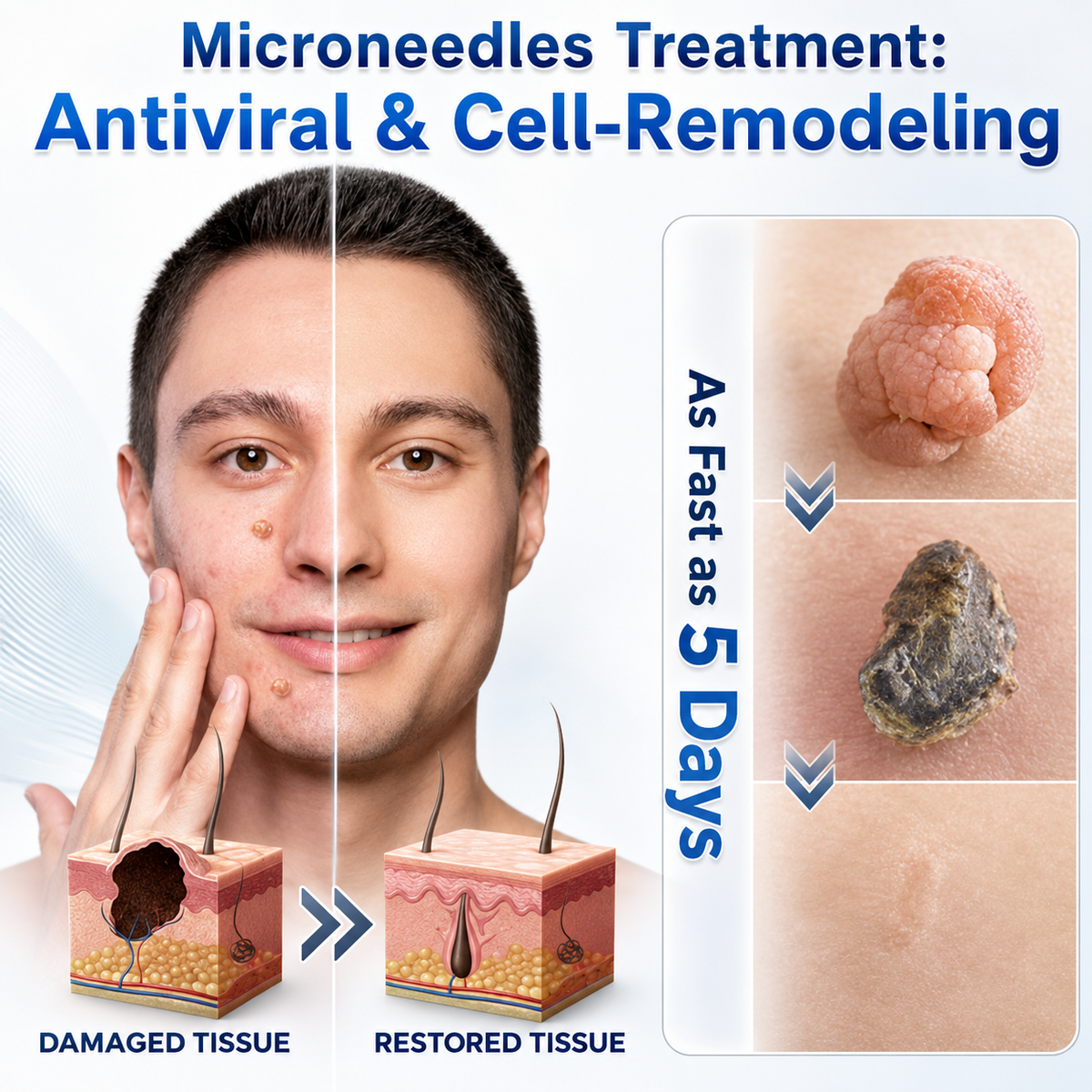👩‍⚕️👪 𝐎𝐟𝐟𝐢𝐜𝐢𝐚𝐥 𝐒𝐭𝐨𝐫𝐞 | 𝑵𝐞𝒌𝐢𝐬𝐬® 🌿 𝐁𝐨𝐭𝐚𝐧𝐢𝐜𝐚𝐥 𝐌𝐢𝐜𝐫𝐨𝐧𝐞𝐞𝐝𝐥𝐞 𝐇𝐲𝐝𝐫𝐨𝐜𝐨𝐥𝐥𝐨𝐢𝐝 𝐏𝐚𝐭𝐜𝐡 (𝐅𝐨𝐫 𝐒𝐤𝐢𝐧 𝐓𝐚𝐠𝐬, 𝐒𝐦𝐚𝐥𝐥 𝐒𝐤𝐢𝐧 𝐆𝐫𝐨𝐰𝐭𝐡𝐬, 𝐖𝐚𝐫𝐭𝐬, 𝐌𝐨𝐥𝐞𝐬, 𝐀𝐠𝐞 𝐒𝐩𝐨𝐭𝐬 & 𝐏𝐢𝐠𝐦𝐞𝐧𝐭𝐚𝐭𝐢𝐨𝐧 𝐂𝐨𝐧𝐜𝐞𝐫𝐧𝐬)