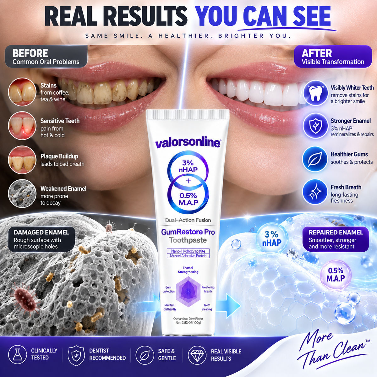 Mussel Adhesive Protein Toothpaste | Nano-Hydroxyapatite