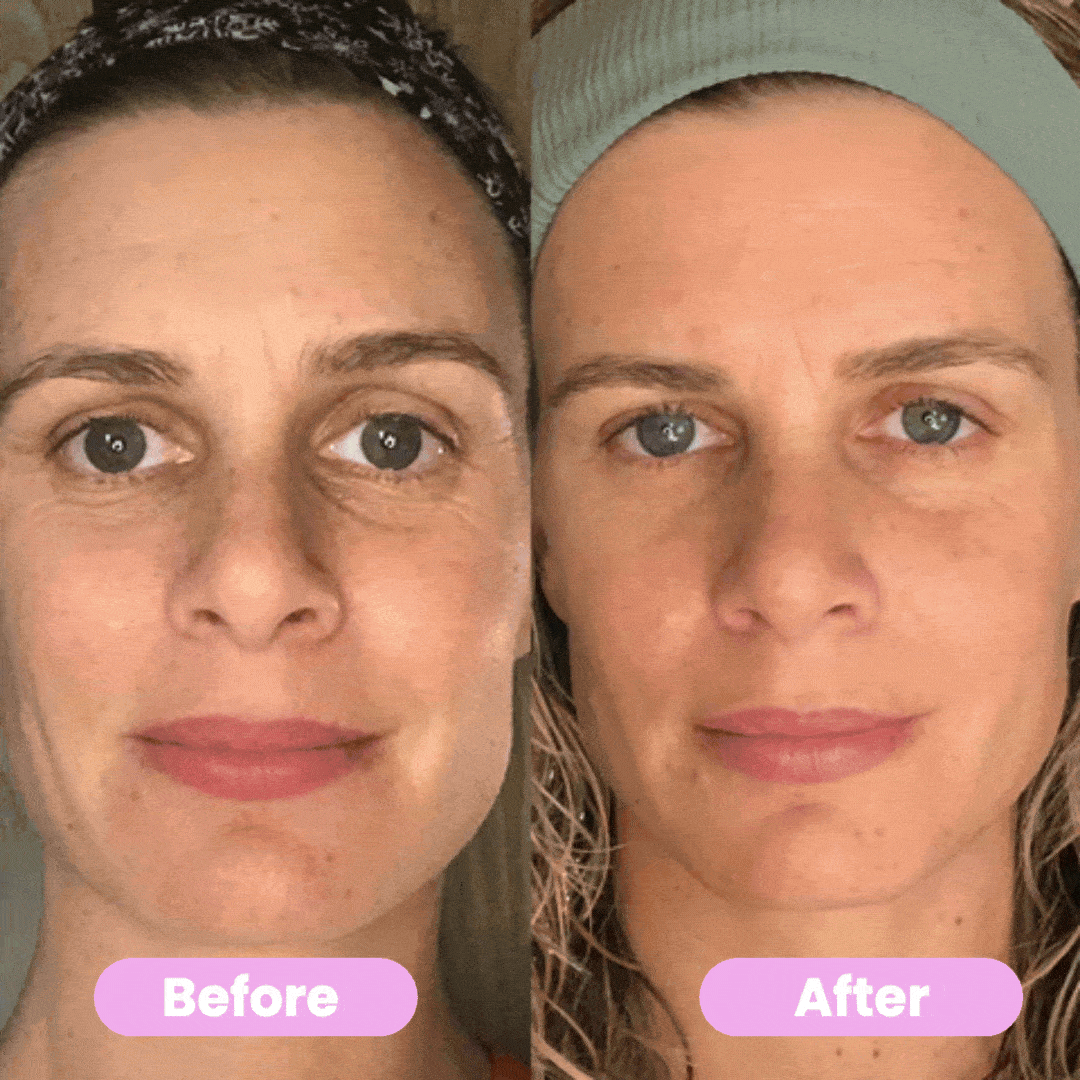 Last Day Promotion 60% OFF🔥 Facial & Neck Skin Lifting Massager