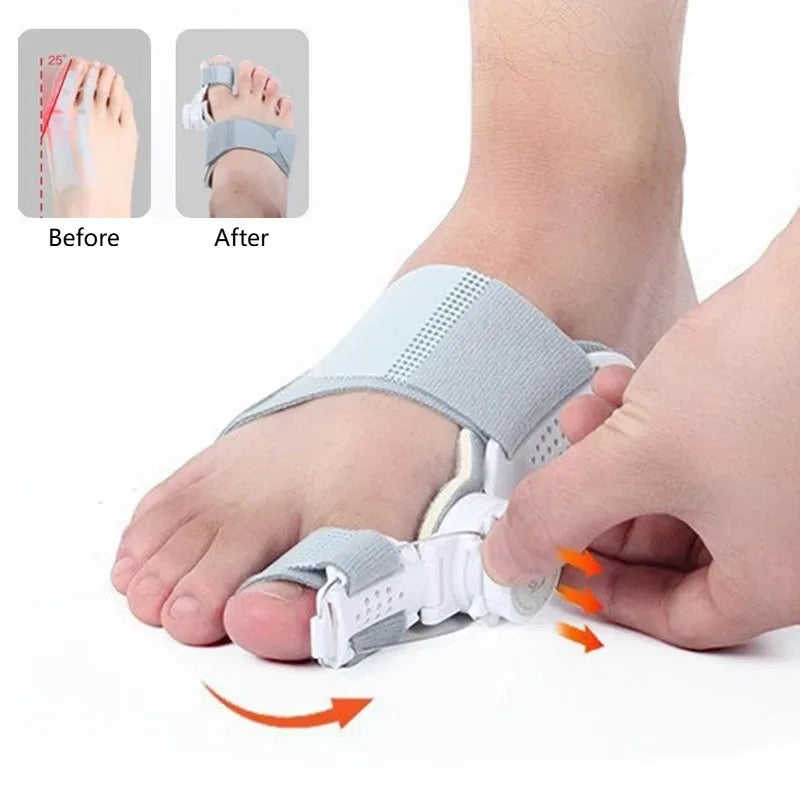 Bunion Corrector