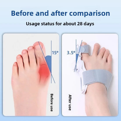 Bunion Corrector