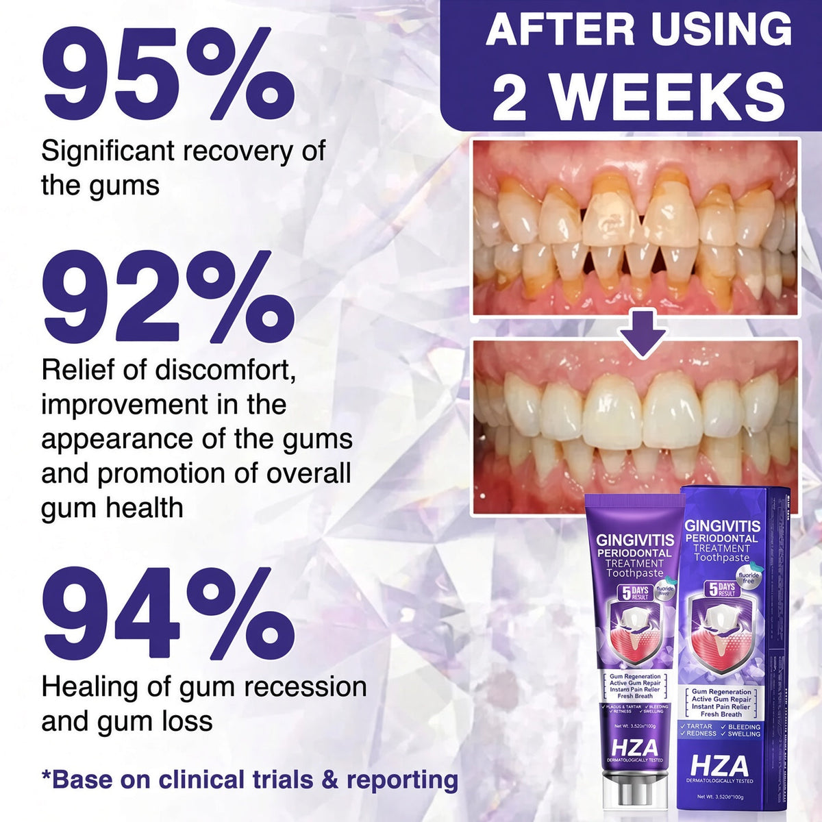 Bee poison Gingivitis & Periodontitis Treatment Toothpaste