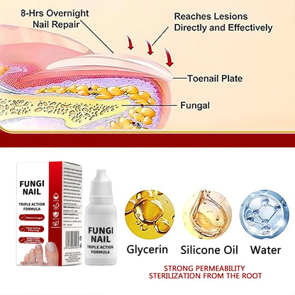 🦶 Fungi Nail Solution | Gentle Formula | Nail Repair & Beauty
