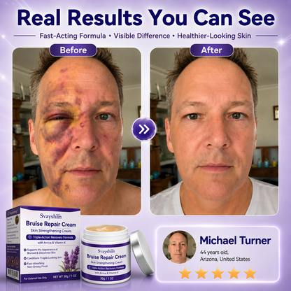 Cream to repair bruises and strengthen the skin