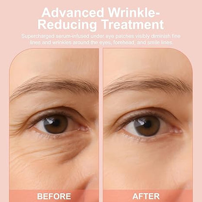 👁️👁️ WAKE UP LOOKING YEARS YOUNGER Hyaluronic Acid Microneedle Eye Mask